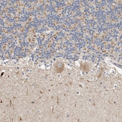 KIF26B Antibody, Novus Biologicals 0.1mL; Unlabeled:Antibodies, Polyclonal